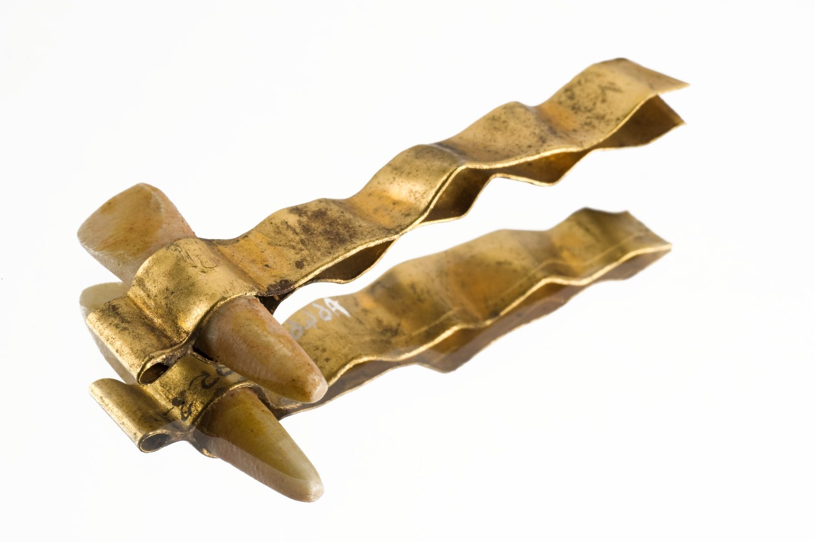 A copy of an Etruscan gold-band dental bridge — a replacement tooth held in a band of gold, fitted to the adjacent teeth. The design dates to before 630 BCE.