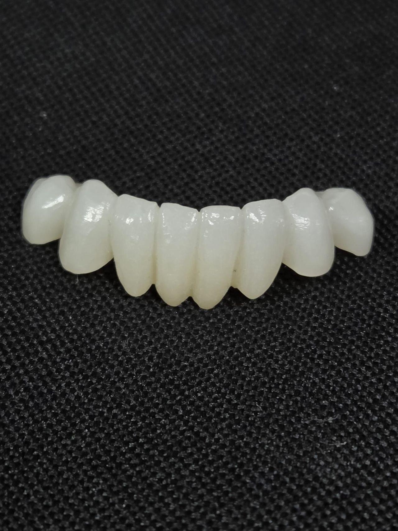 A finished crown-and-bridge restoration on a model at the Natural Esthetics lab in Tampa.